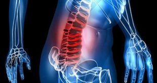 LAS EMOCIONES Y EL DOLOR LUMBAR