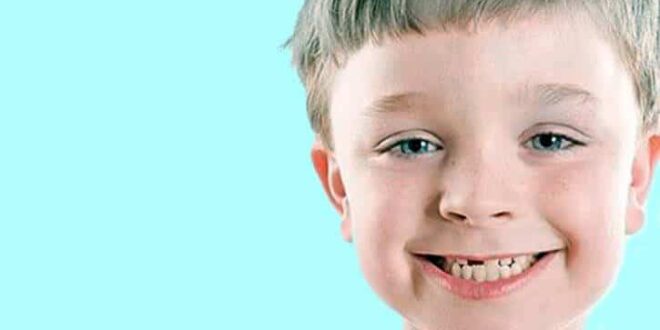 LOS DIENTES Y SUS CONFLICTOS EMOCIONALES
