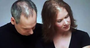 EL CABELLO Y SUS CONFLICTOS EMOCIONALES