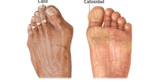 CONFLICTO EMOCIONAL EN LA DOLENCIA DE LOS PIES